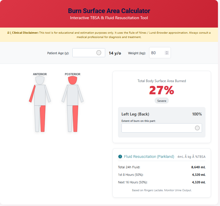 Burn surface area calculator